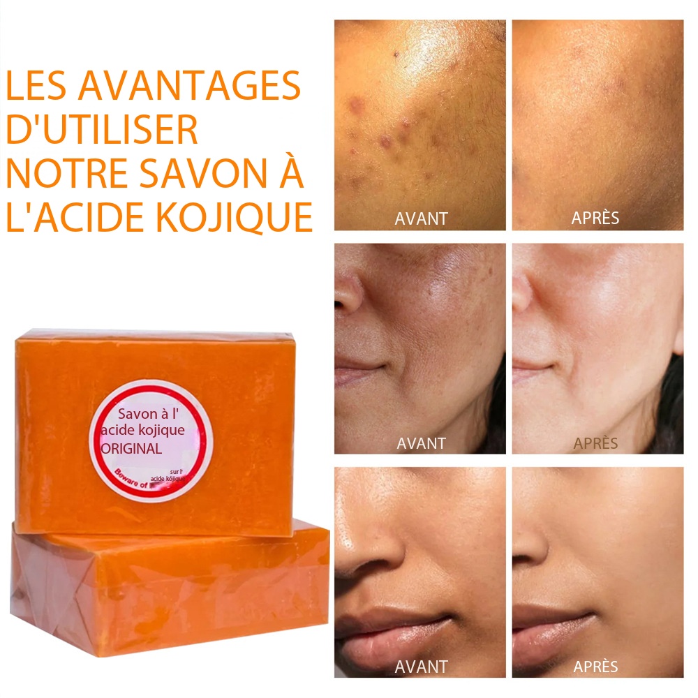 Kojic Acid Soap - Deep Cleansing Demo 0010