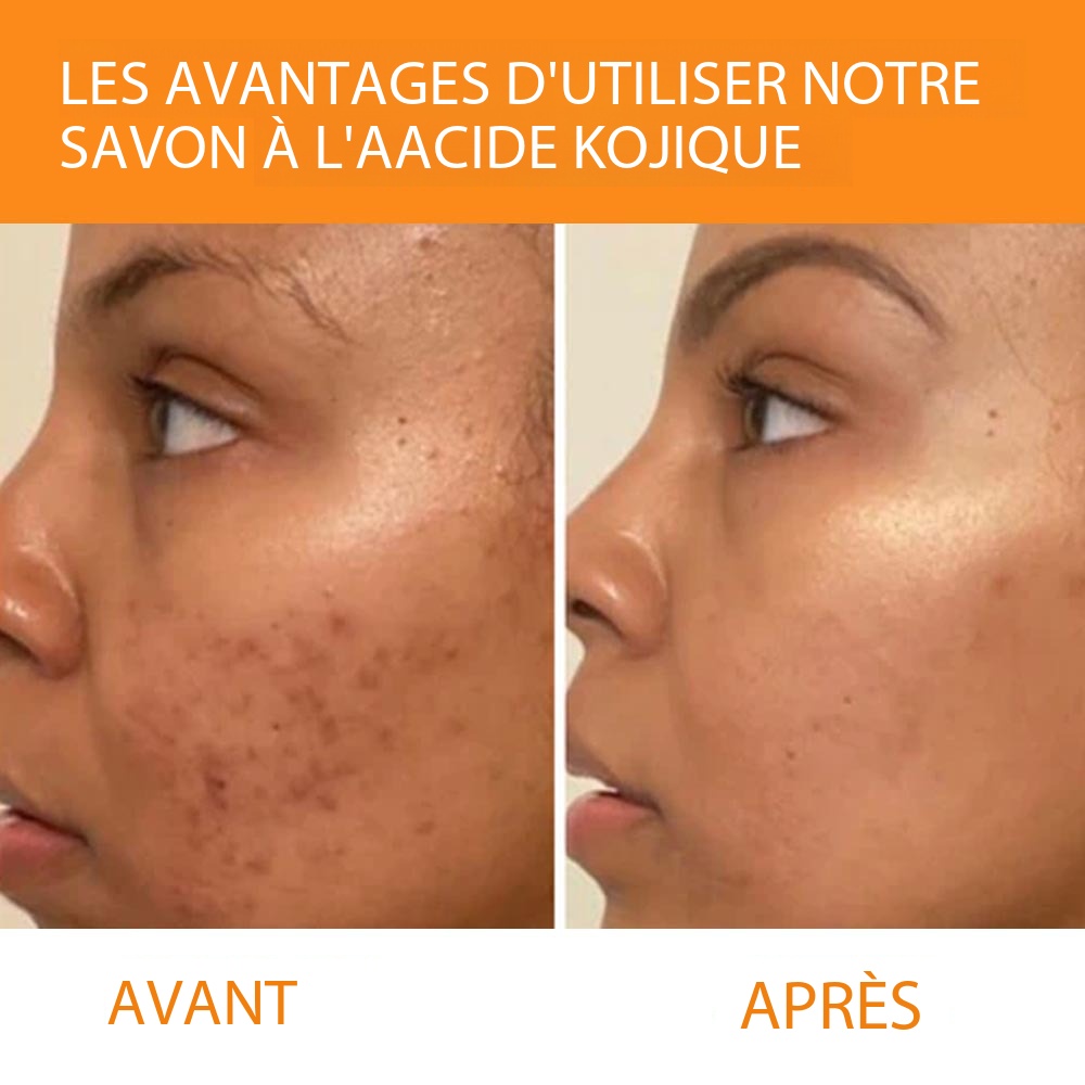 Kojic Acid Soap - Deep Cleansing Demo 005