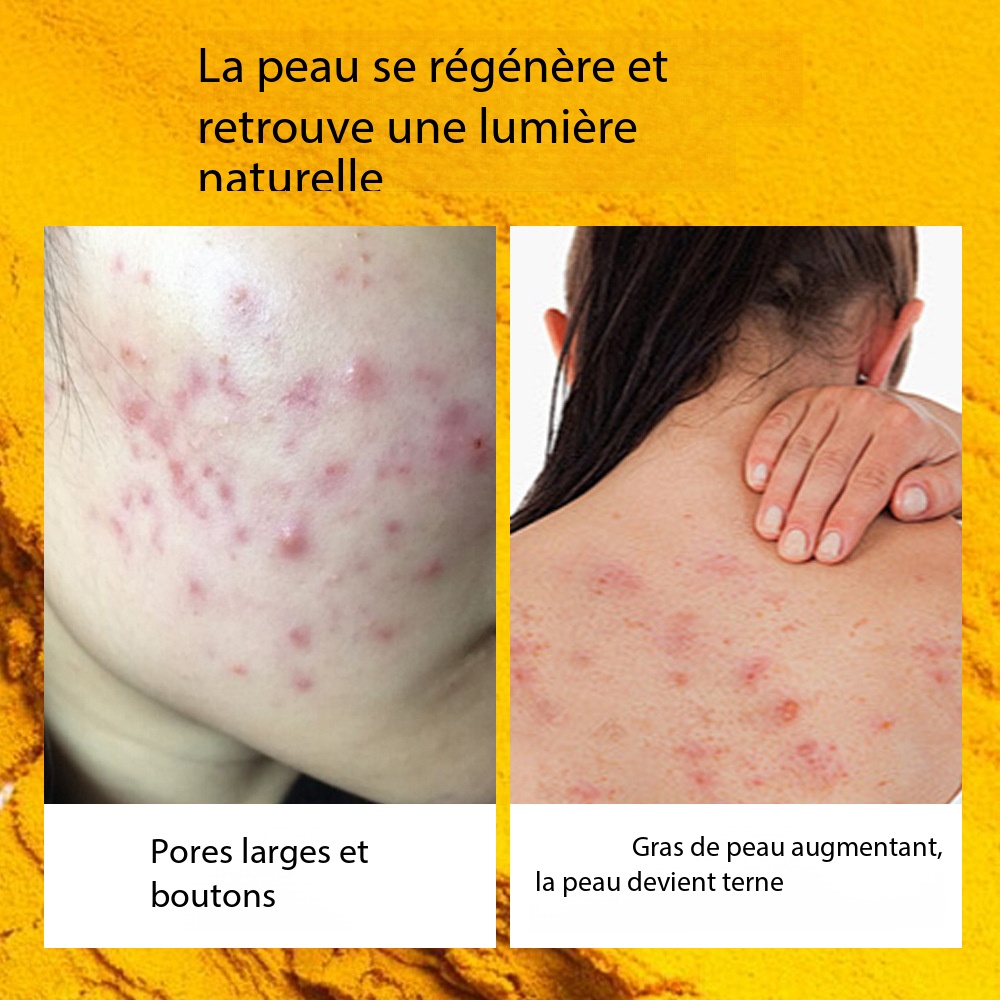 Turmeric soap, brightens the complexion, glow effect BC002 Demo 02
